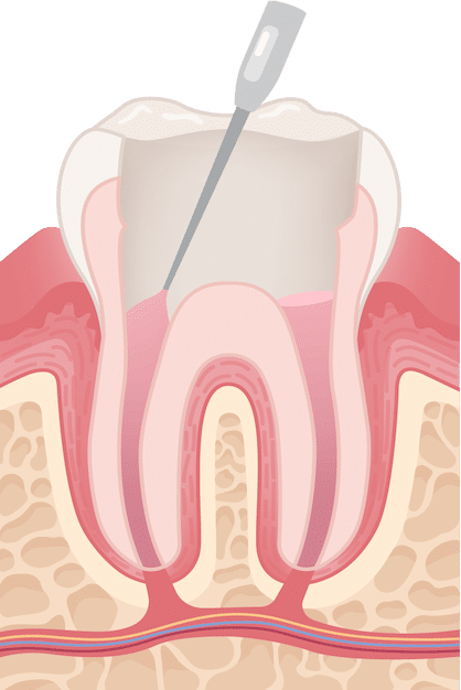 Content Timeline Image