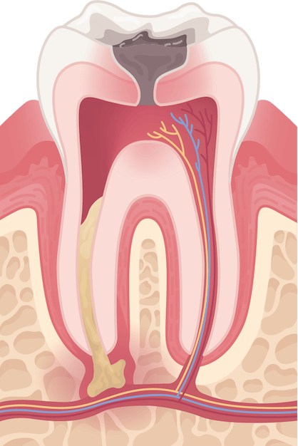 Content Timeline Image