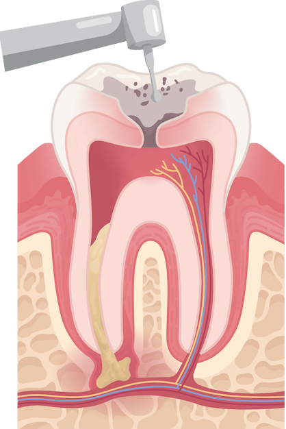 Content Timeline Image