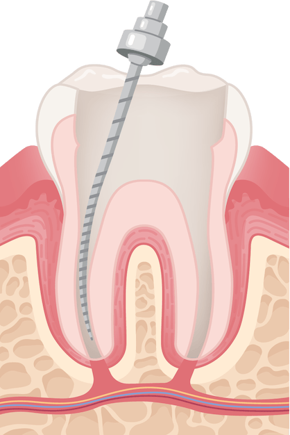 Content Timeline Image