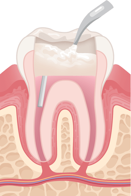 Content Timeline Image