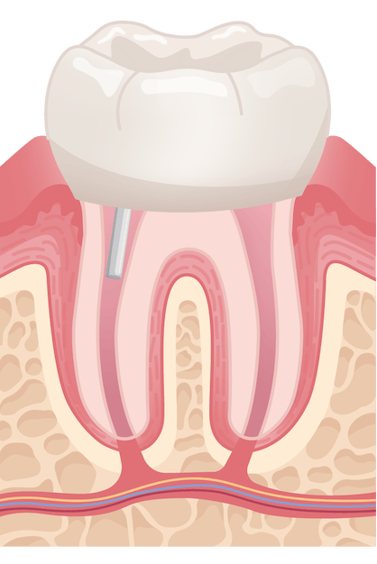 Content Timeline Image